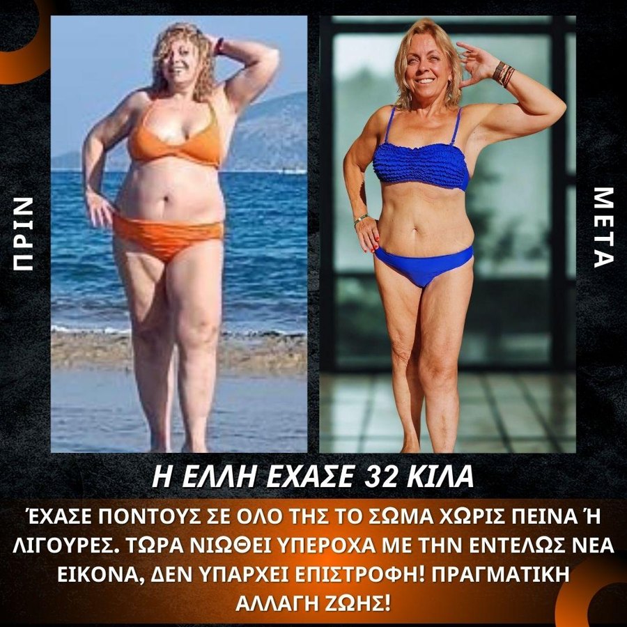 Πριν και μετά: 32 κιλά κάτω, χωρίς πείνα και χωρίς λιγούρες